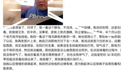 bfa2b2501a32f7a.jpg